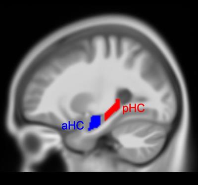 Structural Covariance Changes of Anterior and Posterior Hippocampus During Musical Training in Young Adults